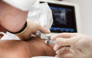 Bone Marrow Concentrate