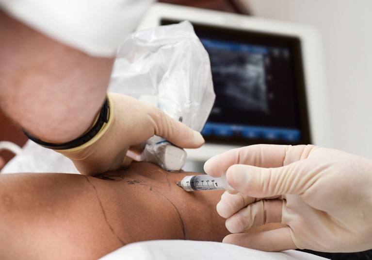 Bone Marrow Concentrate