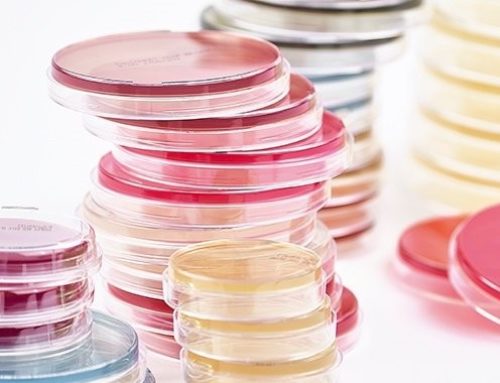 Nutrient Agar Plate- Know Your Media