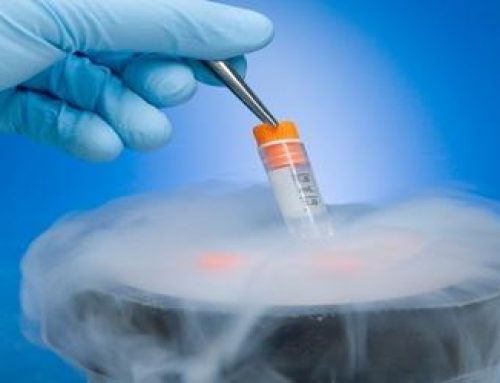 Effects of Cryopreserved Bone Marrow Mononuclear Cells