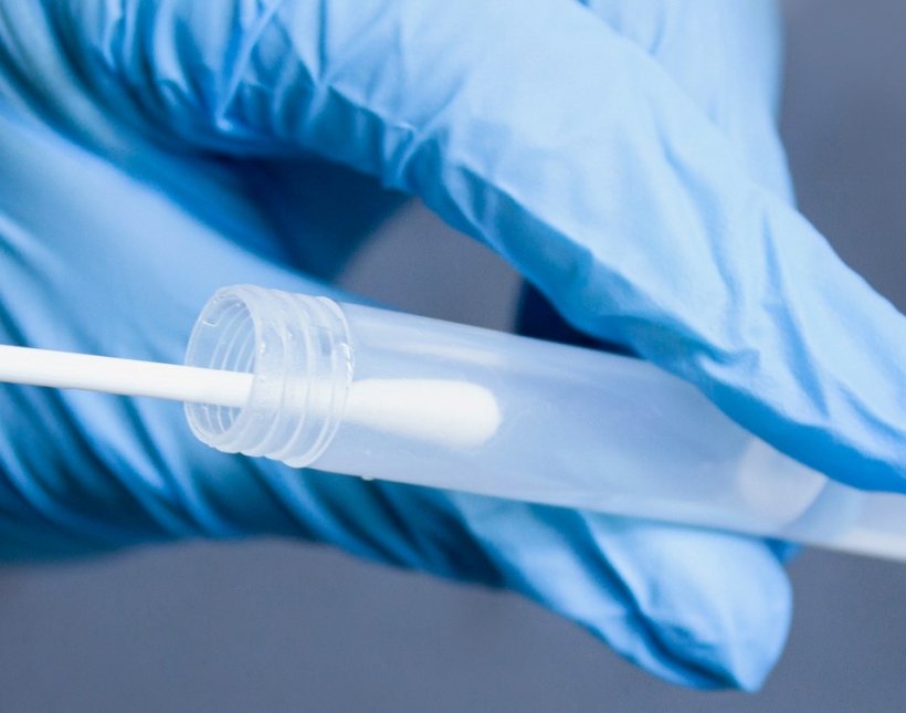 Molecular Transport Media v/s Viral Transport Media